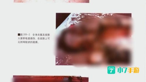 铁道损伤图片